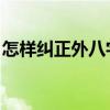 怎样纠正外八字走路 外八字走路是标准姿势）